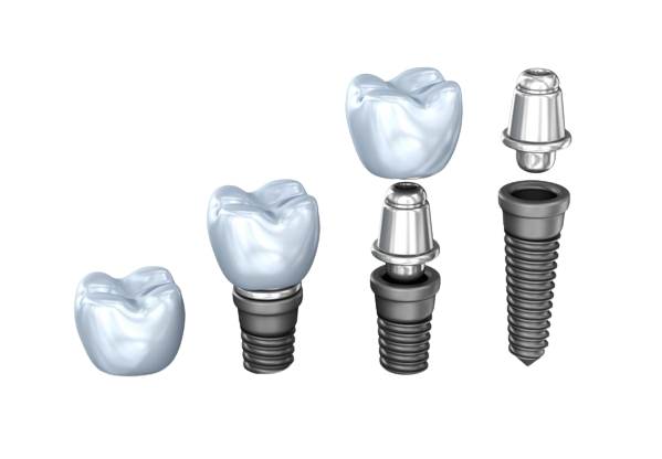 Линия производства стоматологических имплантов